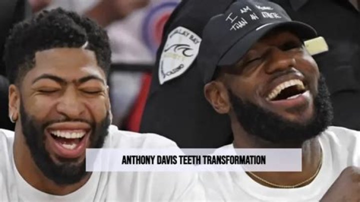 Anthony Davis Teeth Then And: Uncovering The Transformation